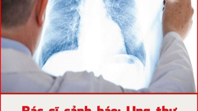 Bác sĩ cảnh báo: Ung thư phổi giai đoạn đầu không phải lúc nào cũng có ho, chú ý 4 bất thường này