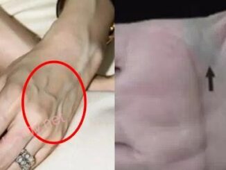 Nhìn thấy ai có “gân xanh” nhất định phải nói cho họ biết điều này, vì sẽ cứu sống họ đấy