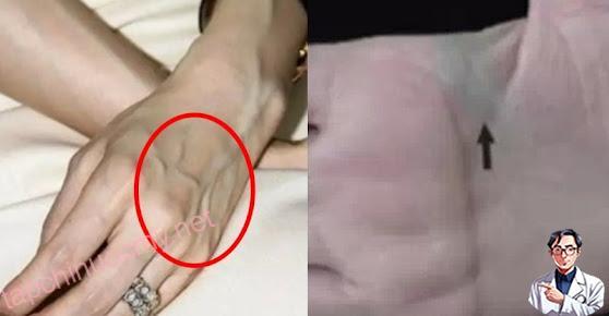 Nhìn thấy ai có “gân xanh” nhất định phải nói cho họ biết điều này, vì sẽ cứu sống họ đấy