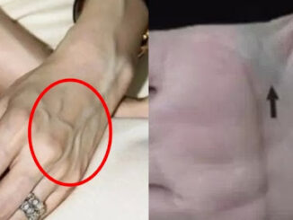 Nhìn thấy ai có “gân xanh” nhất định phải nói cho họ biết điều này, vì sẽ cứu sống họ đấy