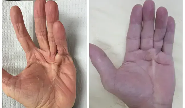 Trước khi UT đến, tay chân thường có 4 dấu hiệu này