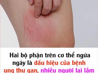 Hai bộ phận trên cơ thể ngứa ngáy là dấu hiệu của bệnh ung thư gan, nhiều người lại lầm tưởng là dị ứng