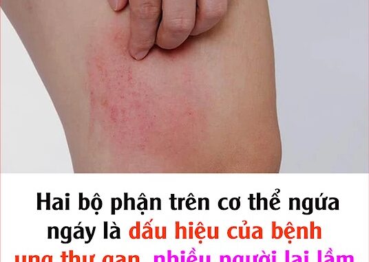 Hai bộ phận trên cơ thể ngứa ngáy là dấu hiệu của bệnh ung thư gan, nhiều người lại lầm tưởng là dị ứng