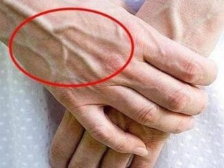 Nhìn thấy ai có “gȃn xanh” nhất định phải nói cho họ biḗt điều nàу, vì sẽ cứu sṓng họ đấy