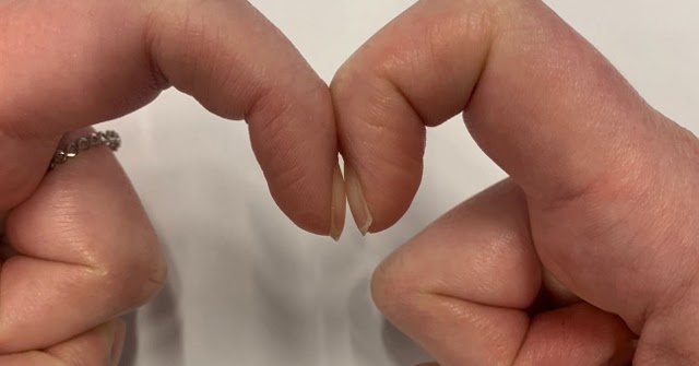 Đặt 2 đầu ngón tay trỏ sát nhau để biết mình bị ung thư phổi không: Cách thử nhanh BS cũng công nhận
