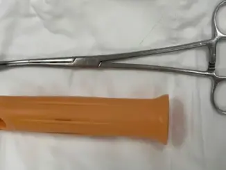 Cấp cứu nam bệnh nhân bị kẹt cán cây lau nhà trong hậu môn