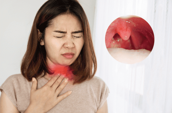 Cảnh báo: Khi thấy cơ thể có dấu hiệu này phải tới bệnh viện ngay kẻo UT vòm họng giai đoạn cuối