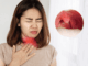 Cảnh báo: Khi thấy cơ thể có dấu hiệu này phải tới bệnh viện ngay kẻo UT vòm họng giai đoạn cuối