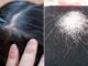 Thường xuyên nhổ tóc bạc, tóc sâu gây ra 4 tác hại này